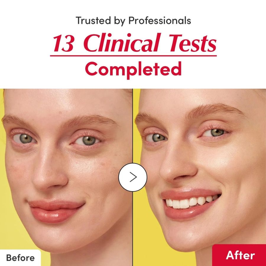 antes y despues eqqualberry vitamin illuminating rostro